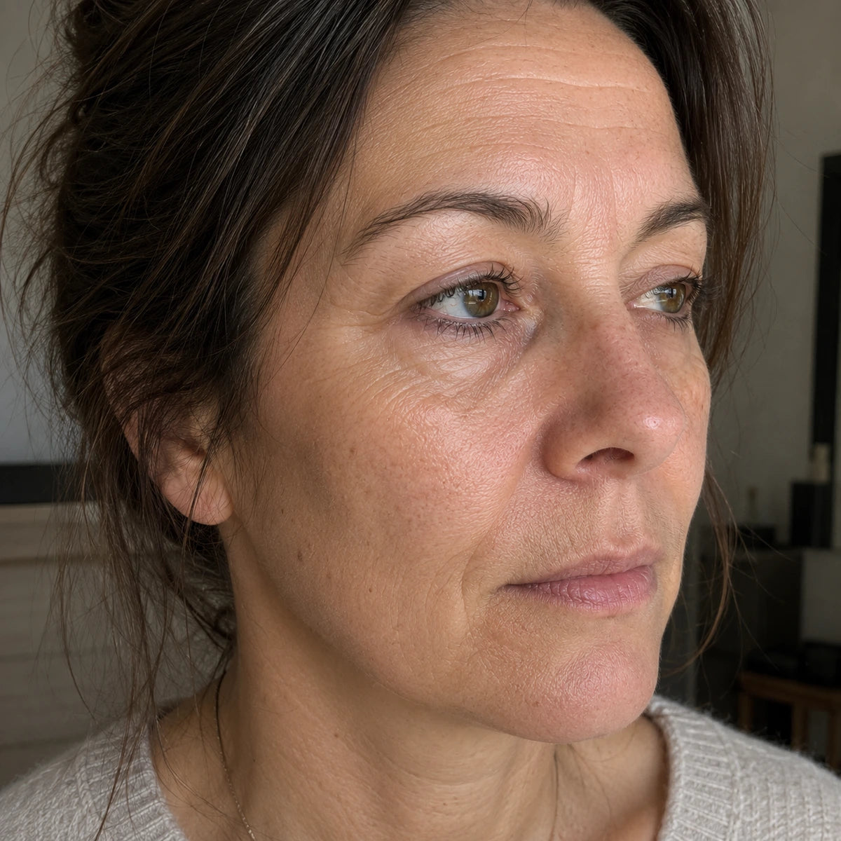 Visage présentant rides ridules manque de fermeté et déshydratation avant l’utilisation du Protocole Inaltérable de Valnay